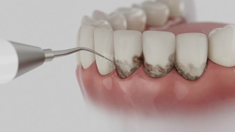 Trusted Dental Implants service in Carmel-by-the-Sea, CA - Dentist Open Now